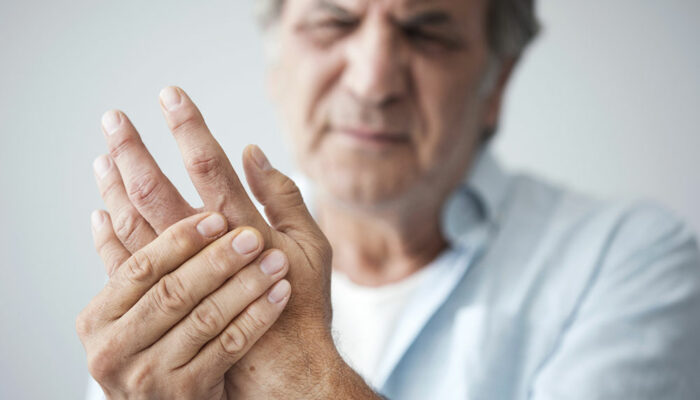 Arthritis – Types, signs and risk factors
