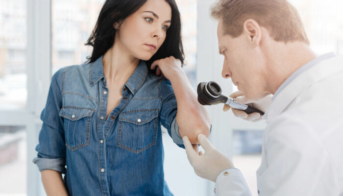 4 common signs of developing psoriasis